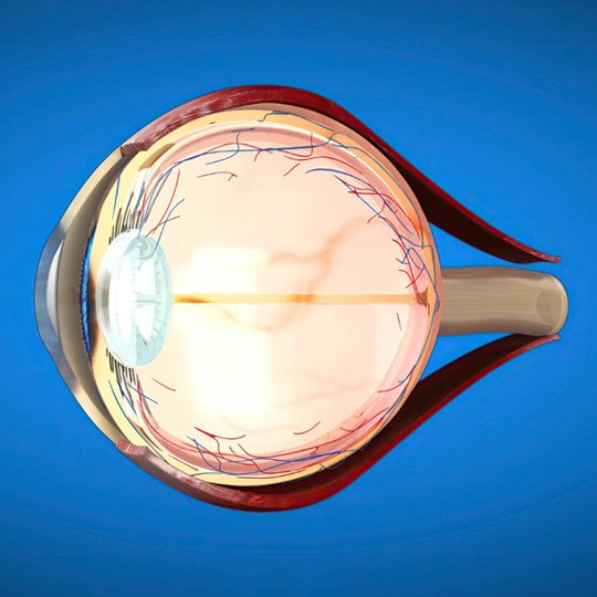 Glaucoma Treatment